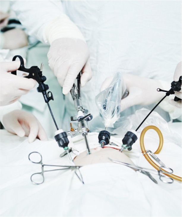 Gastro Surgery