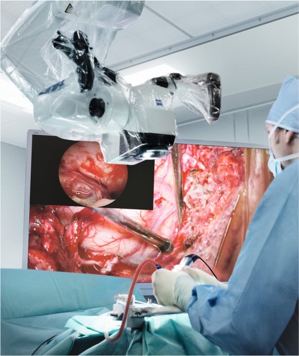 Neuro Surgery
