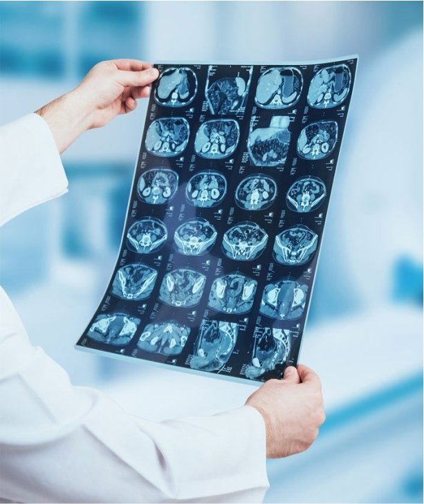 Radio diagnosis