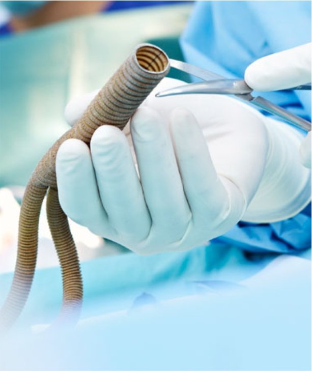 Peripheral & Vascular Surgery