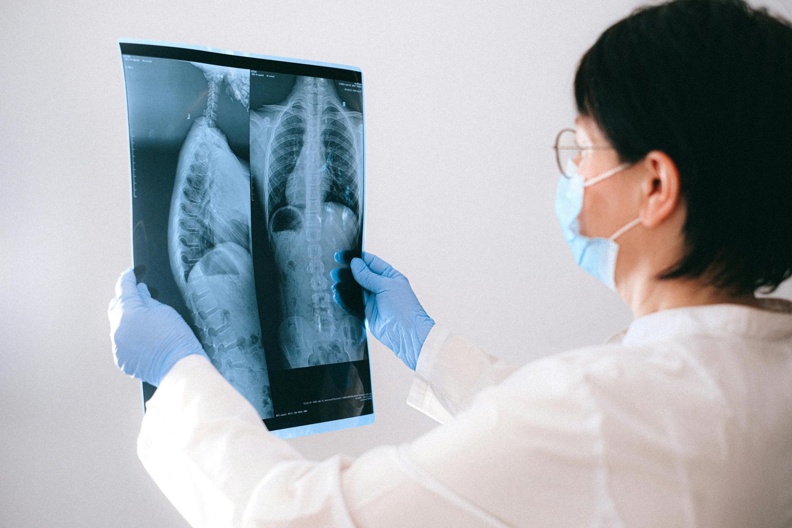 Radio-Diagnosis